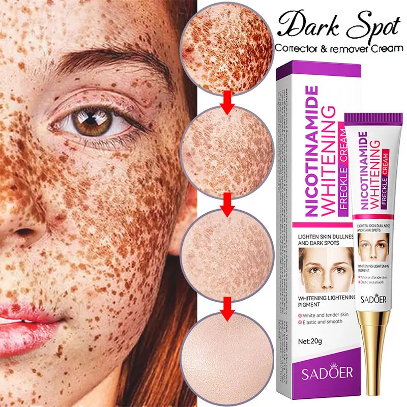 

Nicotinamide Whitening Freckles Cream Remove Melasma Dark Spot Acne Marks Lightening Melanin Brightens Skin Tone Face Skin Care