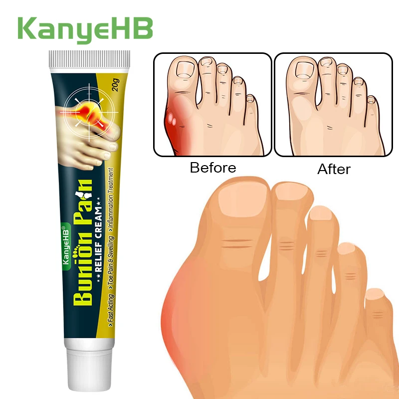 1Pcs Foot Gout Cream Arthritis Bone Thumb Corrector Finger Hallux Toe Bunion Joint Pain Relief Herbal Medical Care Ointment G049 knee pain relief cream pain relief cream skin care ointment