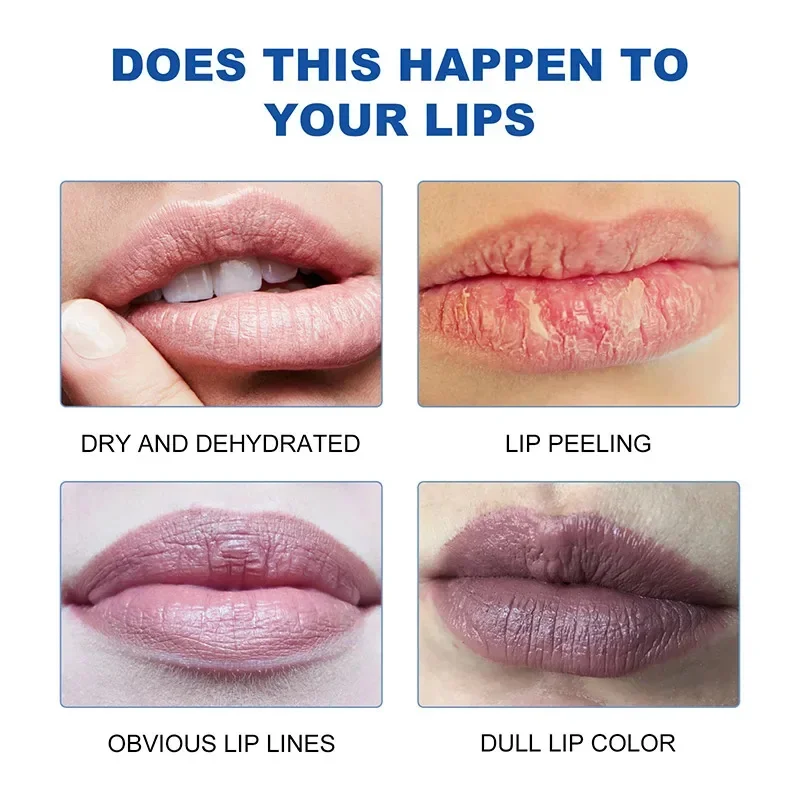 LIPOXI