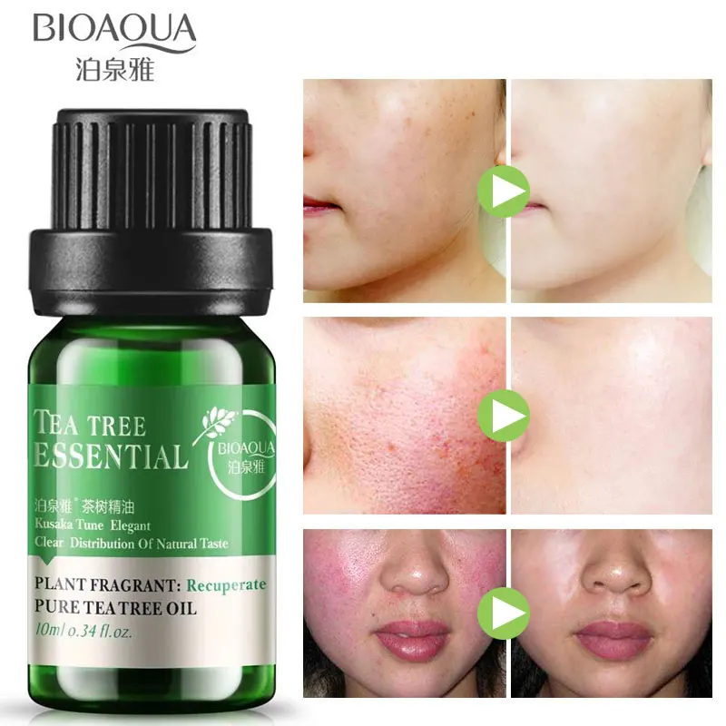 Bioaqua Pure Tea Tree Essential Oil Acne Treatment Blackhead Remover