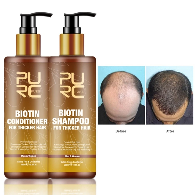 Beauty Hair Growth Essential Oil Biotin Cold-Pressed Blocker and Hair Growth Shampoo Anti-Hair Loss Conditioner