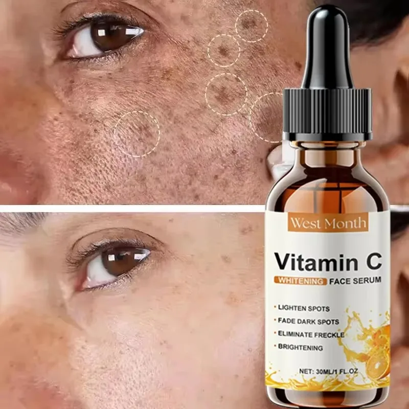Vitamin C Whitening Serum Remove Freckles Dark Spots Face Essence Fade Melasma Melanin Brighten Repair Dull Skin Care Cosmetics 3