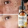 Vitamin C Whitening Serum Remove Freckles Dark Spots Face Essence Fade Melasma Melanin Brighten Repair Dull Skin Care Cosmetics 3
