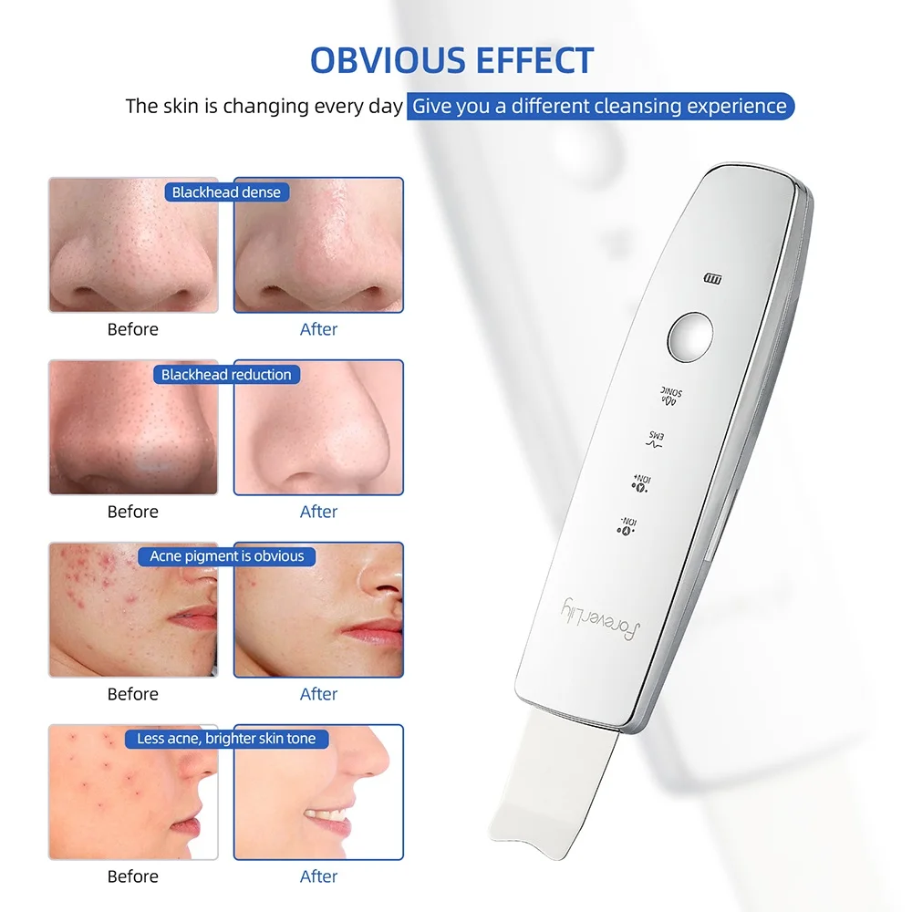 6 in 1 EMS Ultrasonic Skin Scrubber ION LED Photon Skin Lifting Massager Face Spatula Blackhead Remover Facial Deep Cleansing