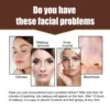 Eelhoe Volcanic Rock Oil-Absorbing Ball Deep Cleansing Sebum Pore Acne Cleanser Block Firming Skin Care Tool Makeup Tool 6