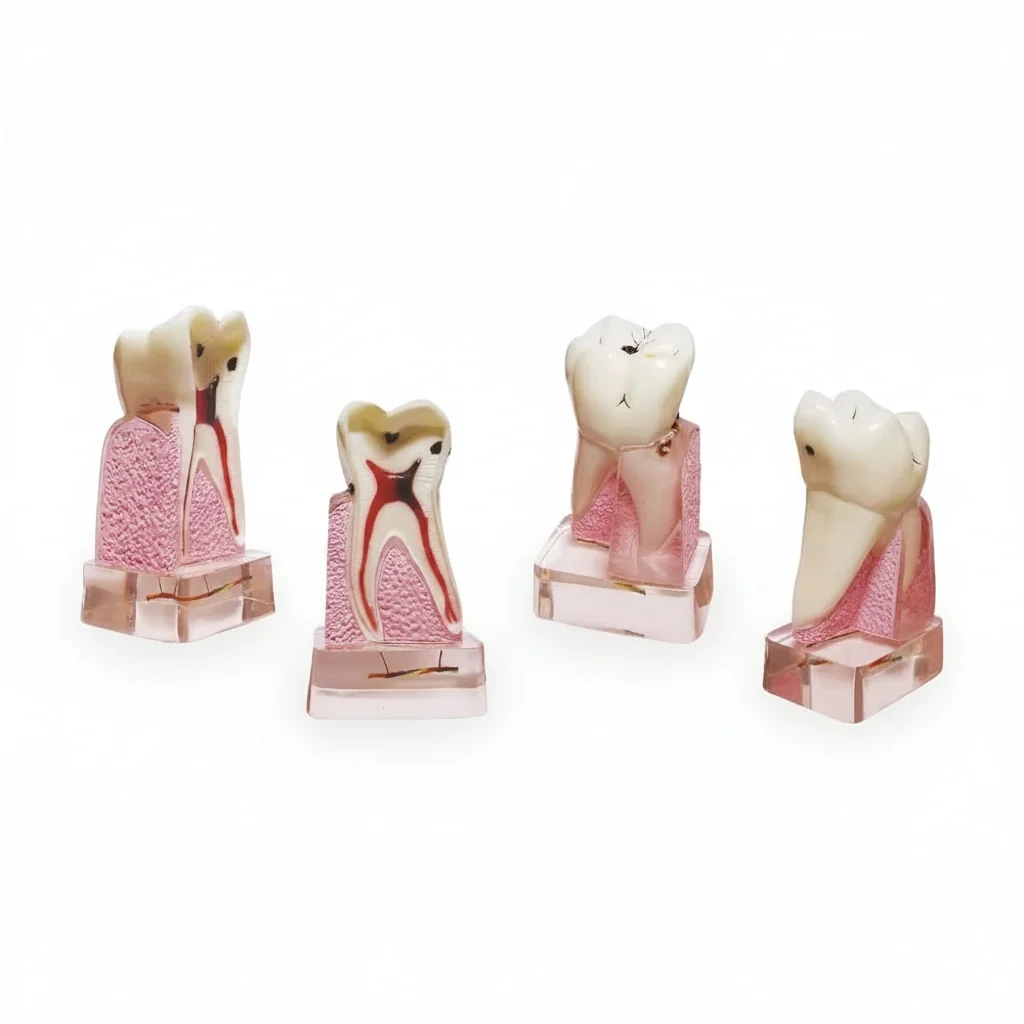 치과 병리학 모형, 4배 확대된 해부학적 치아 모형, 친환경 PVC, 의료 교육..