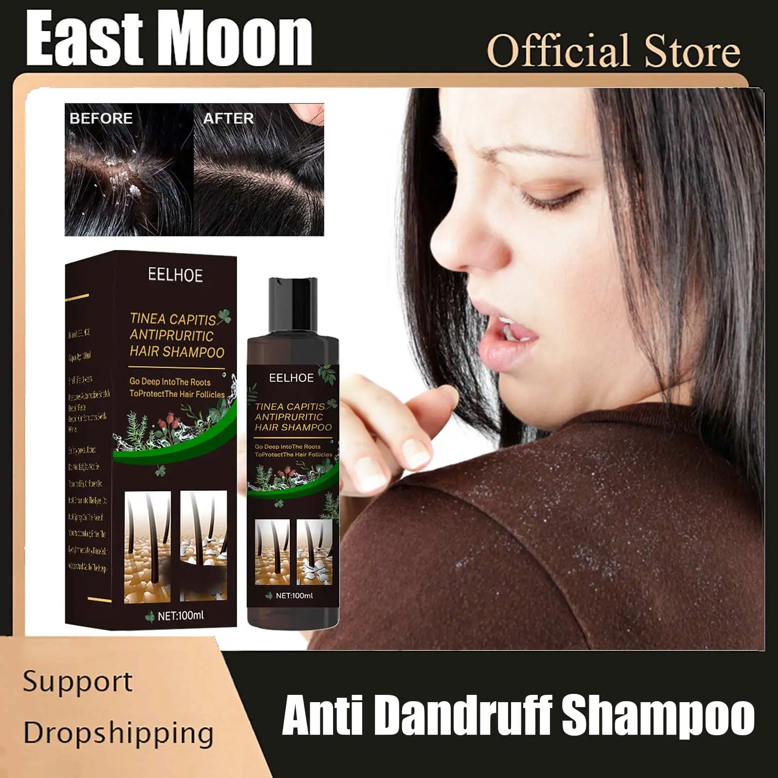 Dandruff Remover Shampoo Therapeutic Shampoo Treatment for Itching