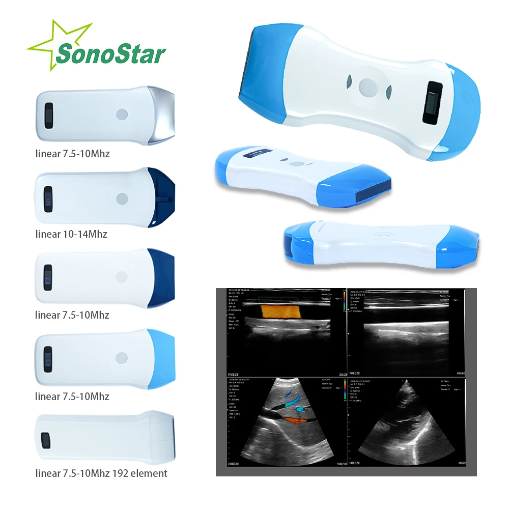 Sonostar Wireless Ultrasound Probe Scanner Machine Portable WIFI linear or convex Machine support iOS Android Windows USG