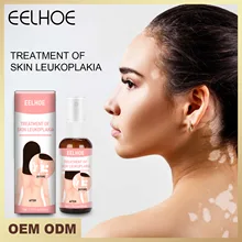 

Eelhoe Treatment Of Skin Leukoplakia White Spot Remover Spray Cream Mycosis Antibacterial Melagenina Leukoplakia Medicine 50ml