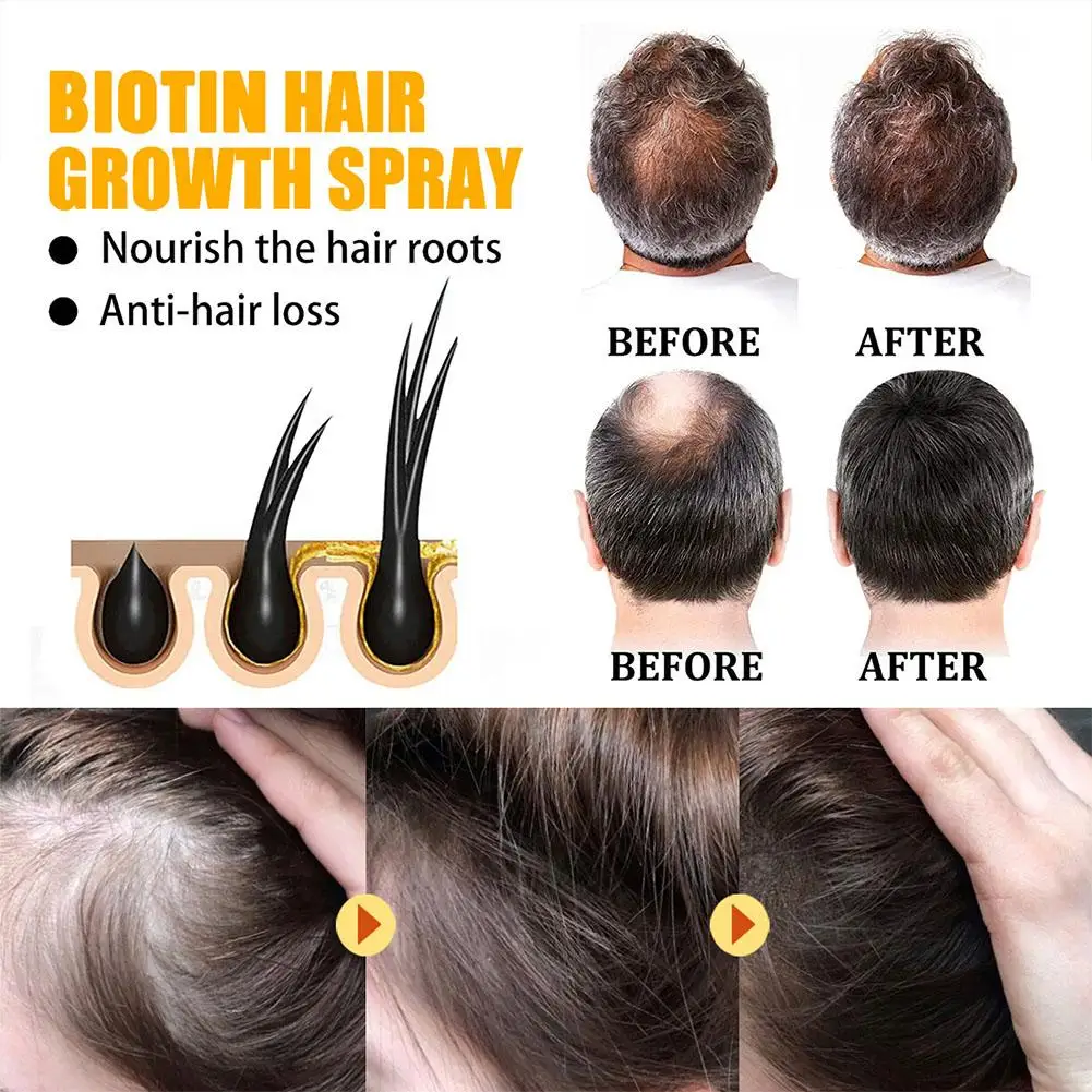 1-5 sztuk produktów do szybkiego rozpylania anty-utrata włosów Serum zapobiegają łysieniu skóry głowy suche uszkodzone olejki eteryczne do włosów