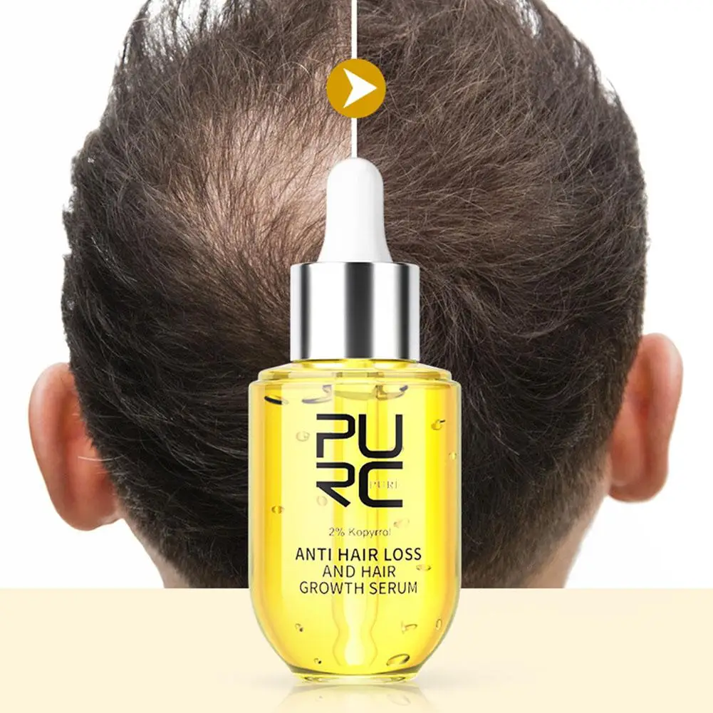 

35/50ml Products Ginger Regrowth Serums Anti Hair Loss Scalp Treatments Serum Liquid For Men And Women G3B1