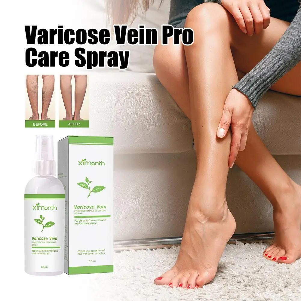 

Spray For Varicose Veins Effective Varicose Vein Relief Cream To Relieve Leg Vasculitis Phlebitis Spider Pain Swelling Treatment