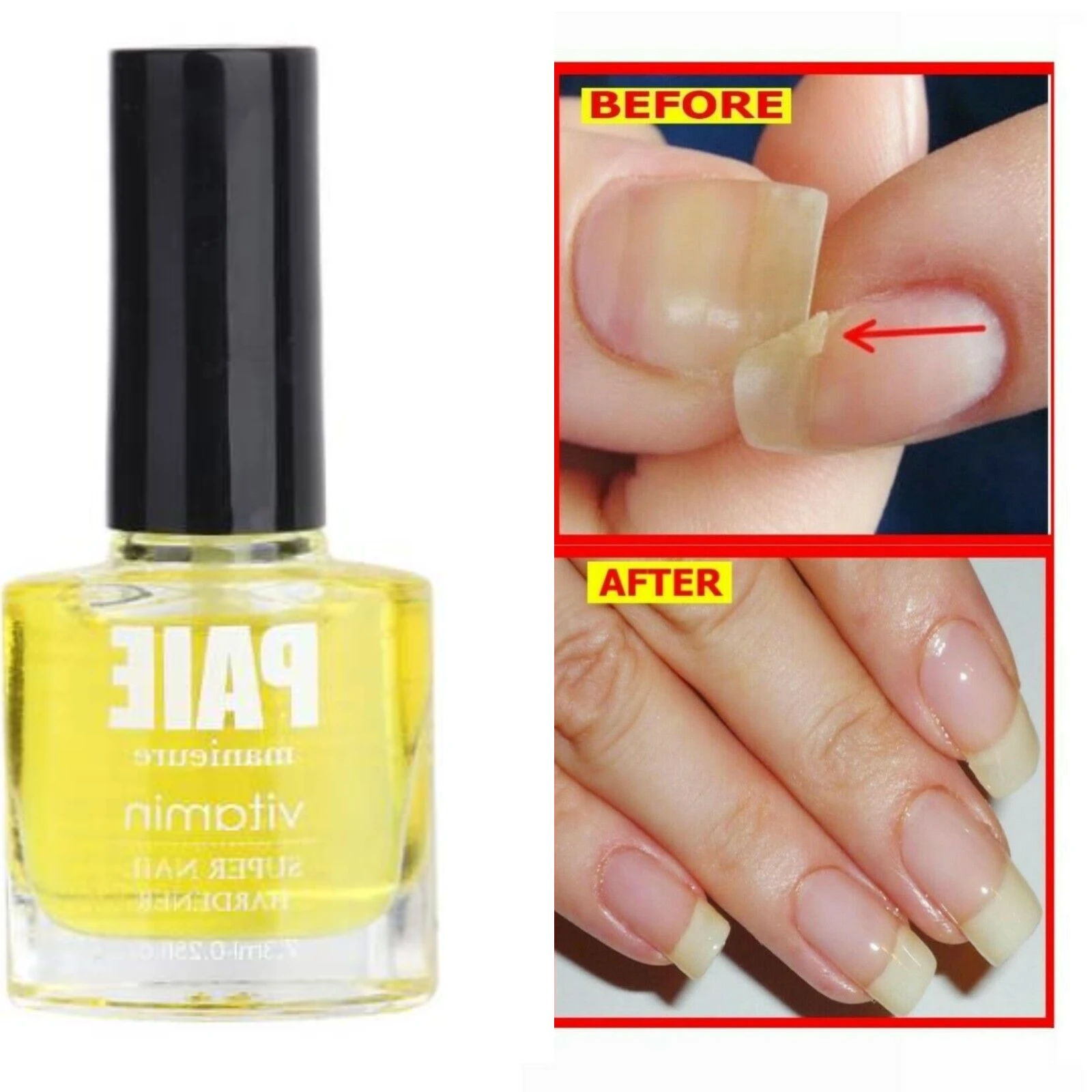 Aggregate 151+ castor oil for brittle nails best songngunhatanh.edu.vn