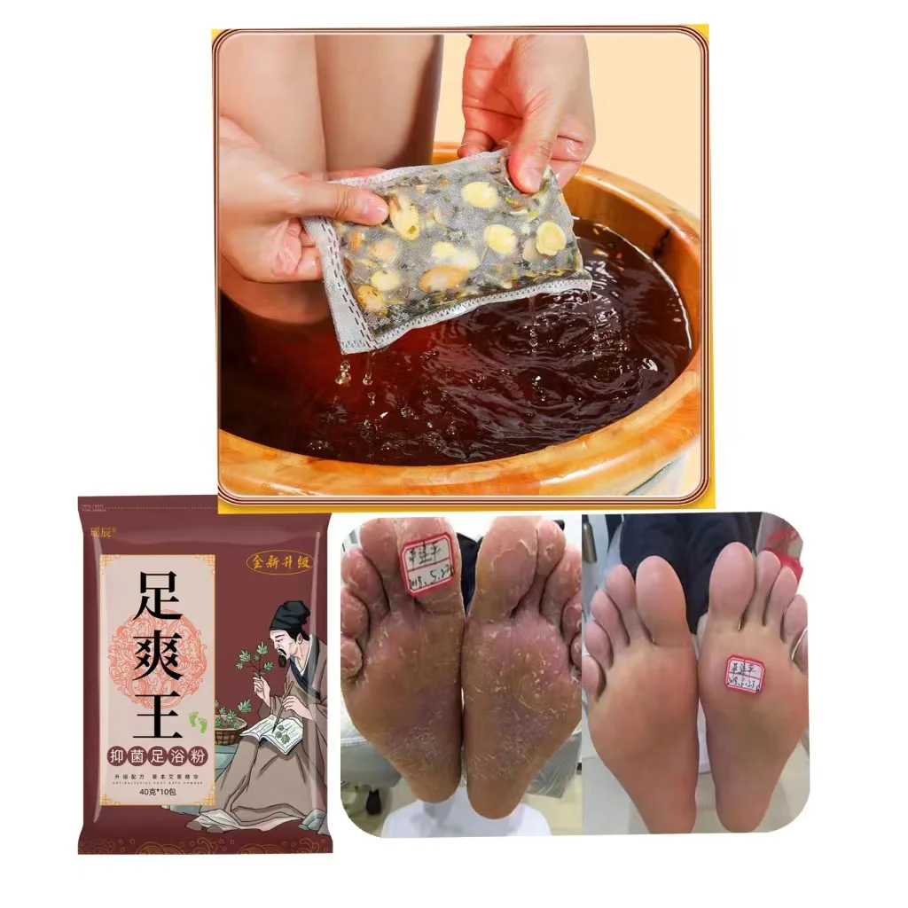 1600g Beriberi Powder Foot Sweat Soak Foot Medicine Pack SPA Deodorization Treatment Itching Blister Peeling Care
