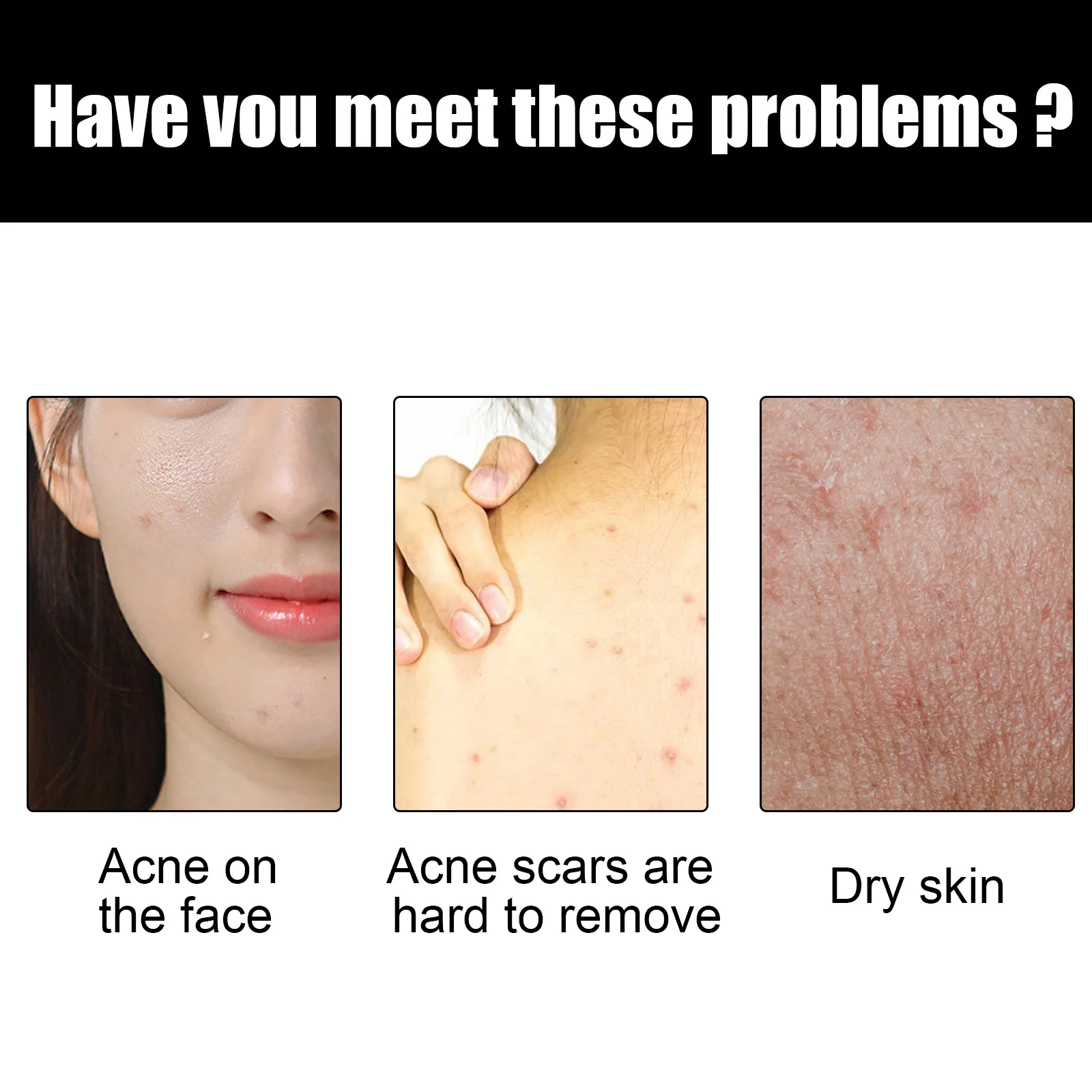 Facial Cleansing Soap Anti Acne Remove Pimples Blackhead Dark Spots Shrink Pores Gentle Moisturizing Soothing Face Wash Cleanser 3