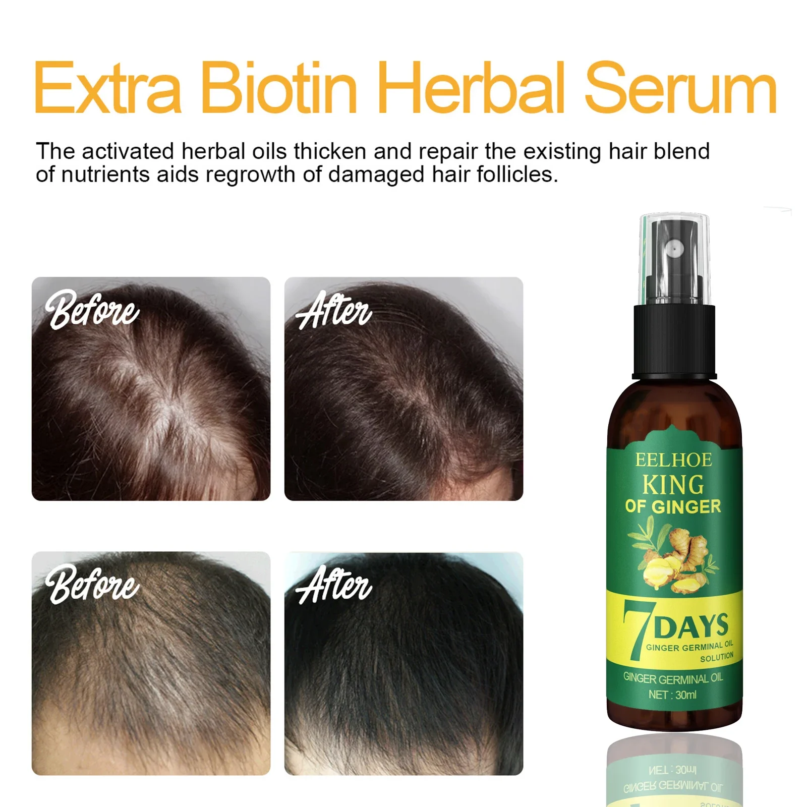 Ginger Care Hair Spray Nourish Hair Roots Massag Scalp RepairHair Growth Essence Quality Control Oil Care Solution