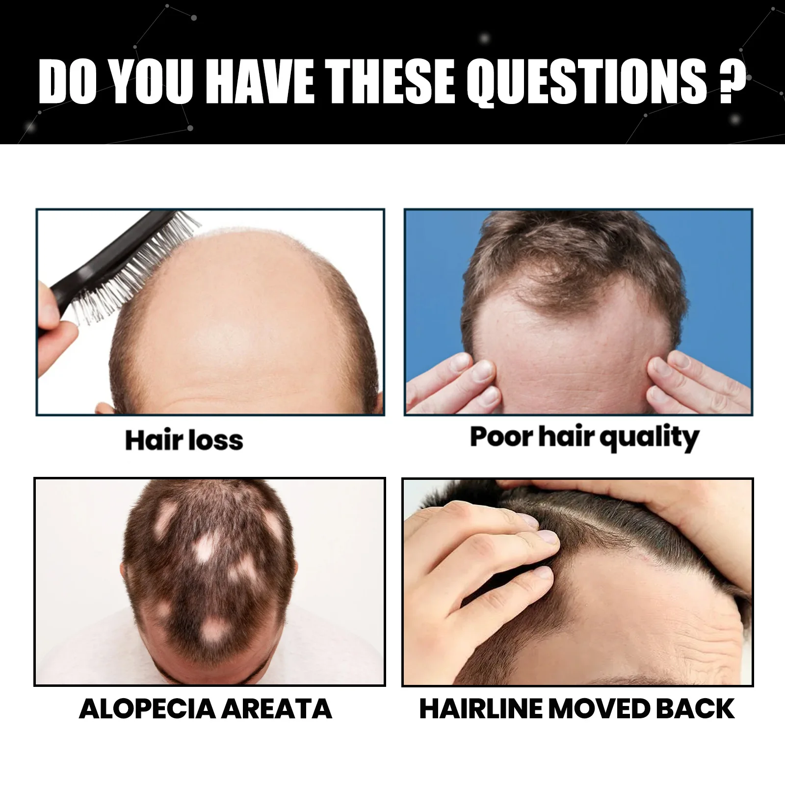 Hair Building Fiber Anti Hair Loss Powder