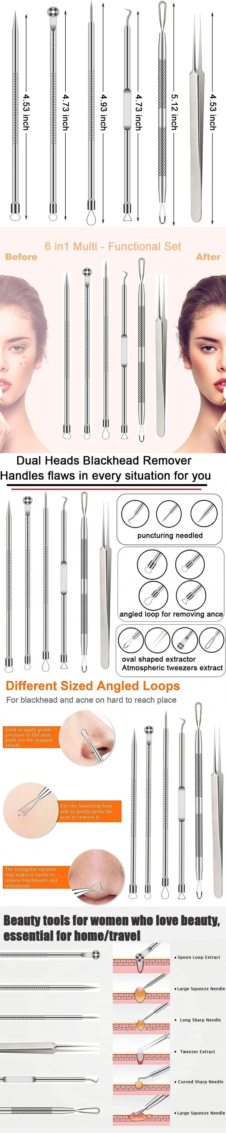 6-Piece Blackhead & Pimple Remover Kit