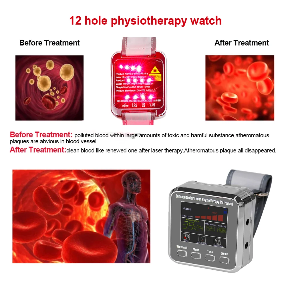 7 Holes 650nm Semiconductor Laser Physiotherapy Watch Wrist Watch For Diabetes Cholesterol Hypertension Treatment Sinusitis