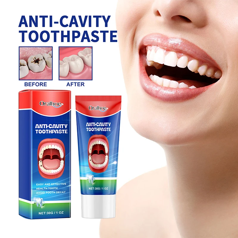 Teeth Health Product 30g Anti Decay Toothpaste Dental Caries Repair Cream Prevent Decay Protect Teeth Remove Plaque Toothache Relieve Periodontitis