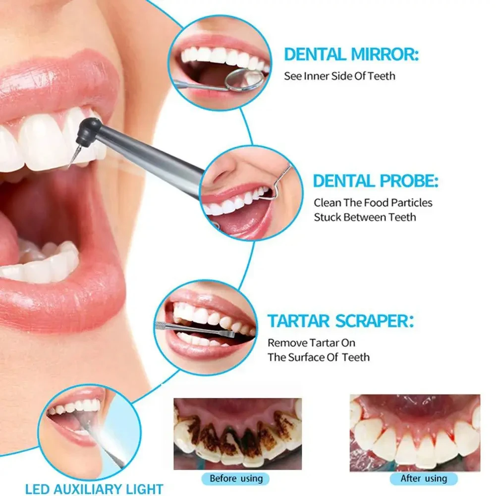 Xiaomi MIJIA Sonic Dental Scaler Tartar Eliminator Scraper for Cleaning Electric Tooth Dental Stone Removal Teeth Whitening Kit 3