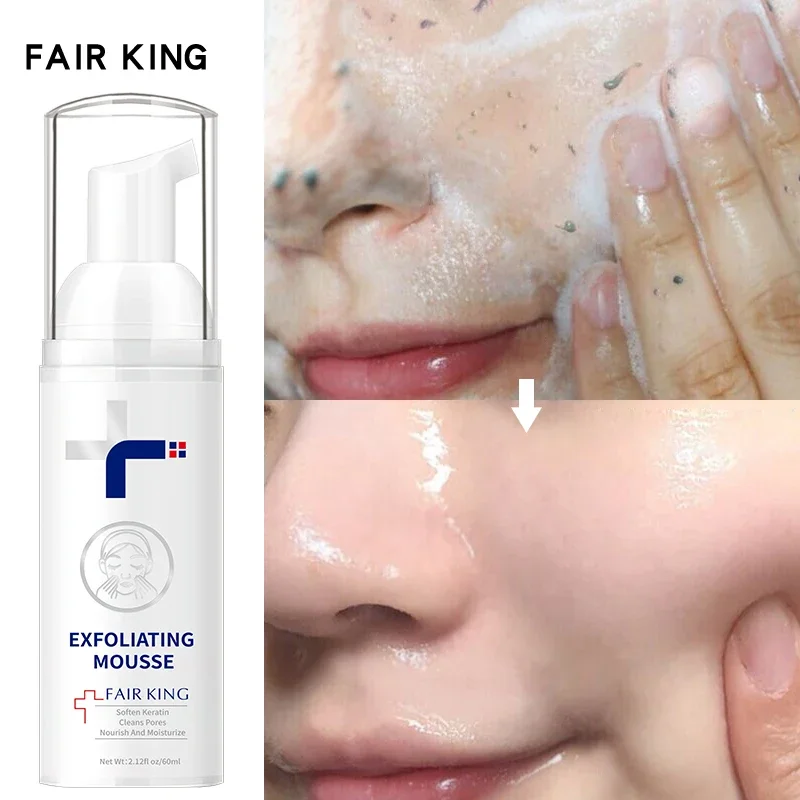 Face Care Foaming Exfoliating Mousse Deep Remove Cleaning All Skin Wash Face Smooth Moisturizing Skin Exfoliator Unblock Pores bath shower scrub gloves exfoliating bath cleaning body bubbler massage sponge wash skin moisturizing spa five fingers