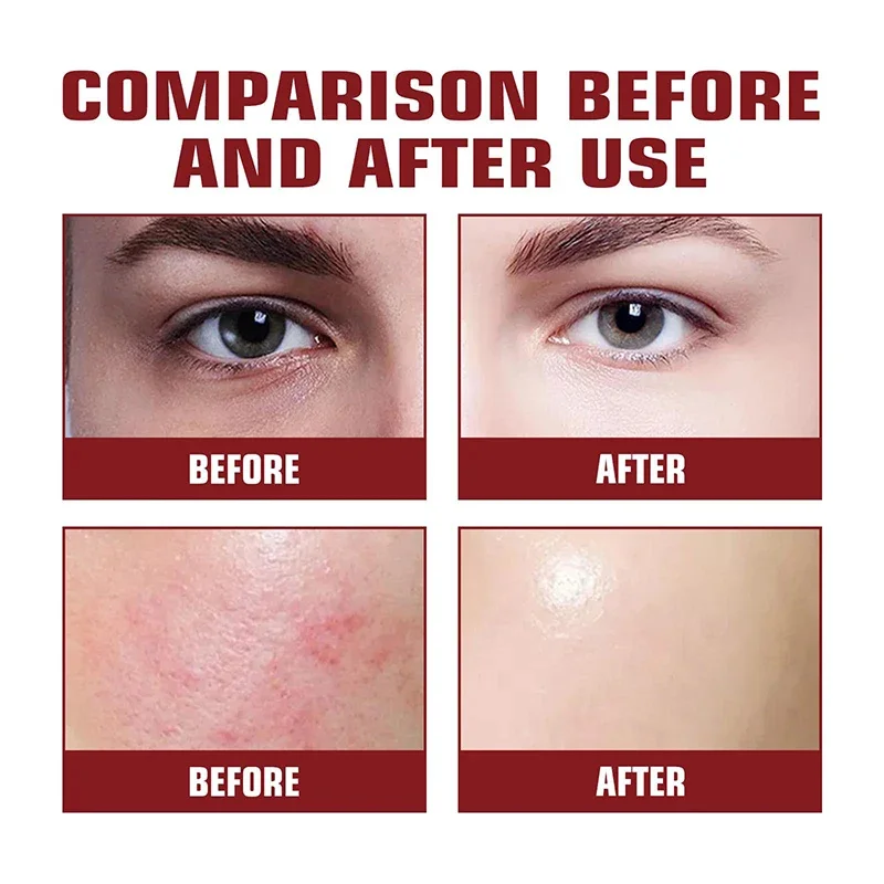 Facial Serum Facial Essence Retinol Face Serum Salicylic Acid Facial Serum