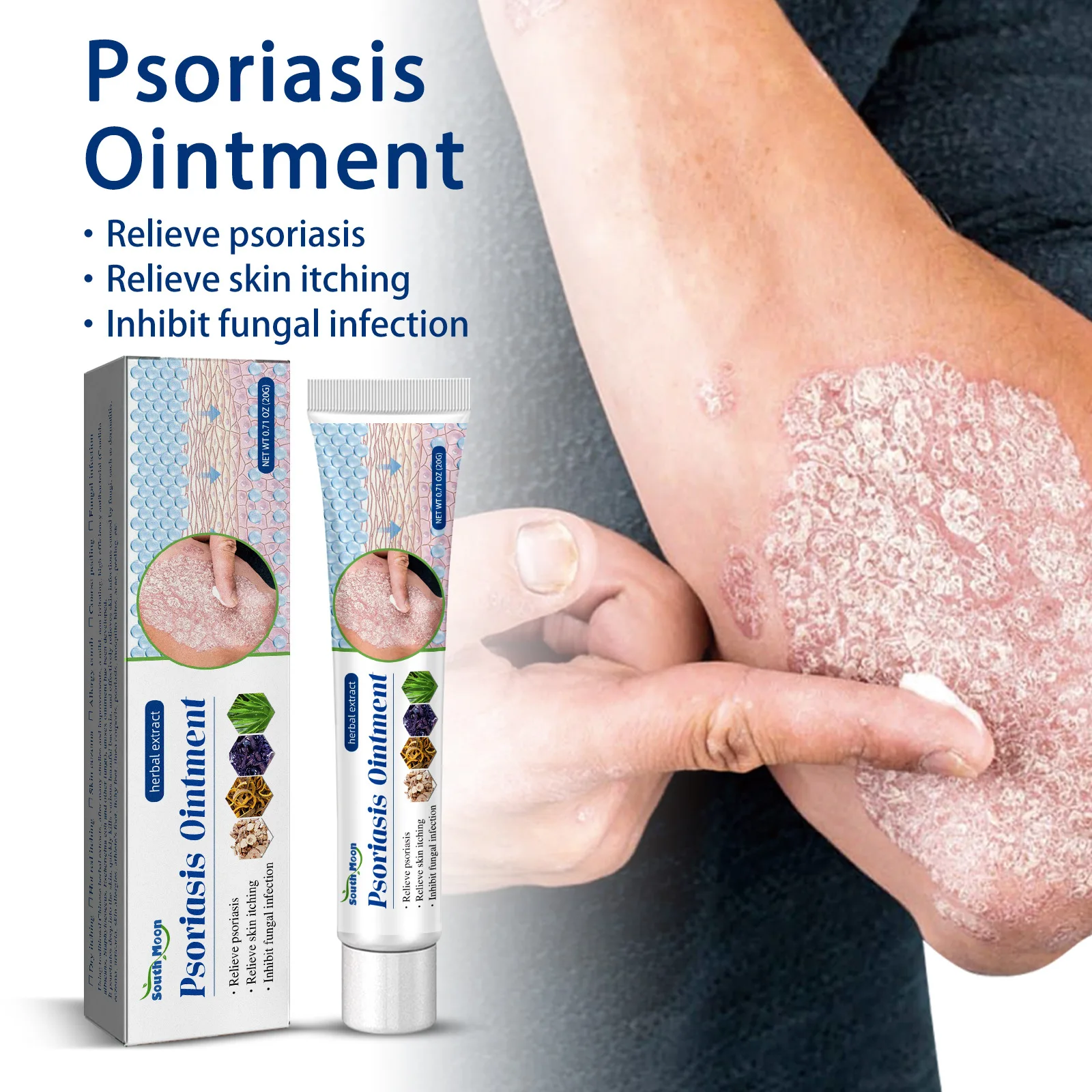 

Psoriasis Cream Dermatitis Eczematoid Ointment Antibacterial Anti-Itching Prickly Rash Urticaria Plaster Skin Care Cream Medical