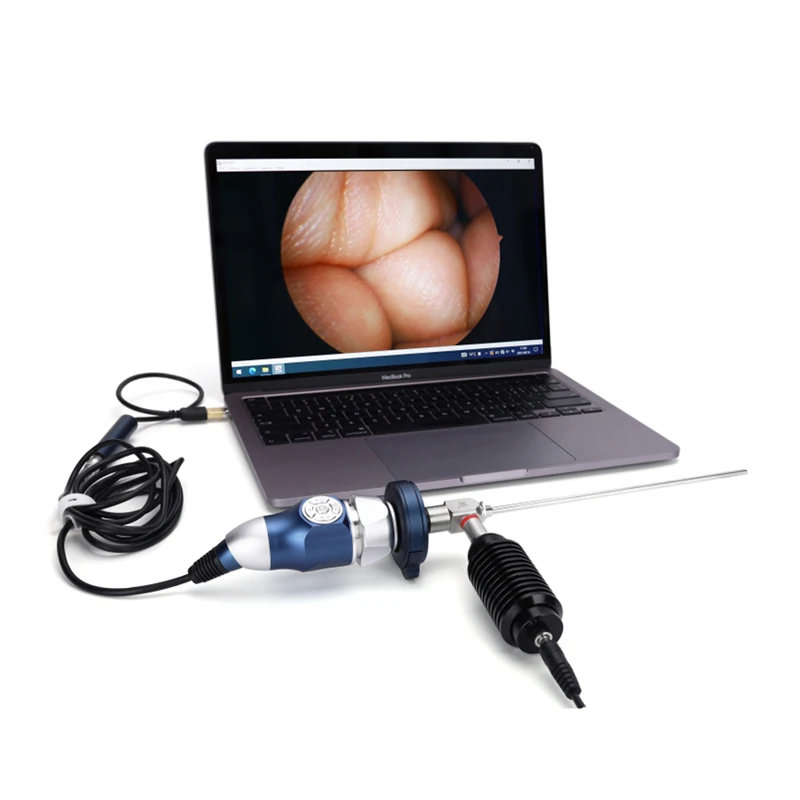 

High Quality HD medical portable USB camera ent endoscope digital video endoscope