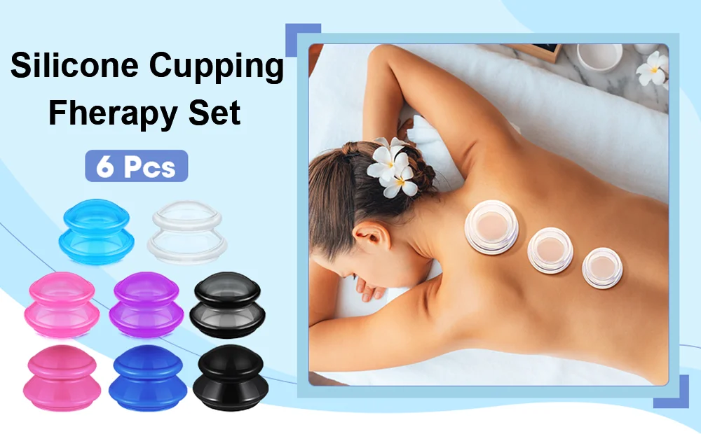 Cupping set overview