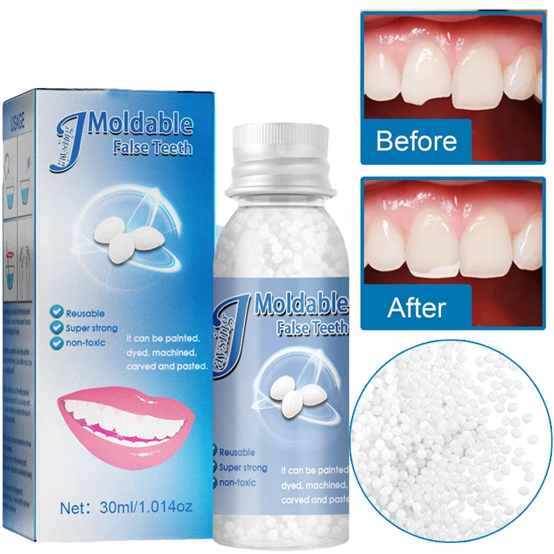 Teeth And Gap False Teeth Solid Glue Resin Missing Broken Teeth Filling Material Temporary Tooth 