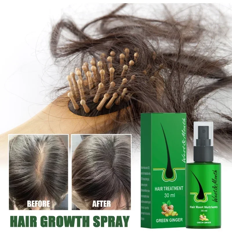 Herbal Hair Growth Products Men women Anti-alopecia Spray Care Scalp Treatment Prevent Hair Loss Essential Oil hair growth oil hair restoration products