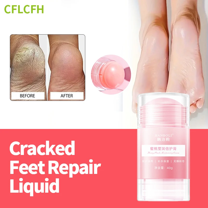 

Anti Crack Foot Cream Heel Cracking Drying Cracked Peeling Feet Repair Hand Dead Dry Removal Moisturizing Skin Care Mask