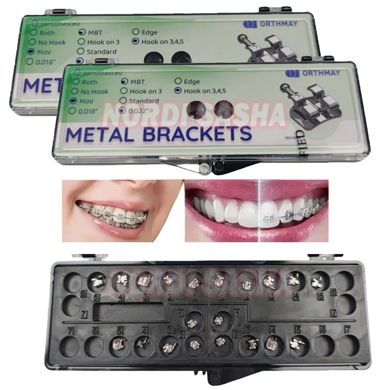 เหล็กจัดฟันแบบโลหะ 1 กล่อง รุ่น Roth 022 ช่องใส่ 345 ตะขอ สำหรับงานจัดฟัน ฐานโลหะแบบตาข่าย บางเฉียบ 1