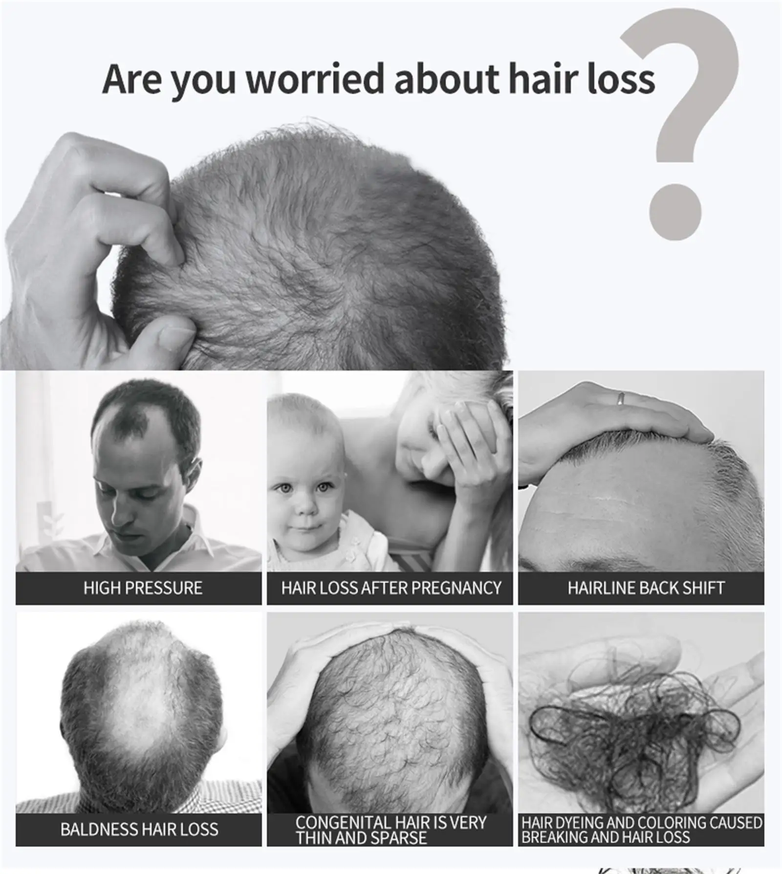 Description Picture 5 of itemPowerful Hair Growth Serum Spray Natural Anti Hair Loss Products Repair Nourish Hair Roots Fast Regrowth Hair Care Men Women