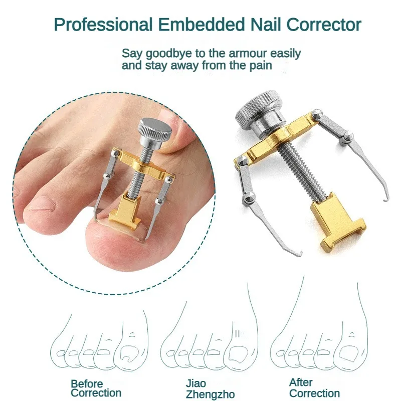 Embedded Nail Corrector Stainless Steel Pedicure Tool Cure Paronychia Corrector Straightening Ingrown Toenails Toe Nail Fixer