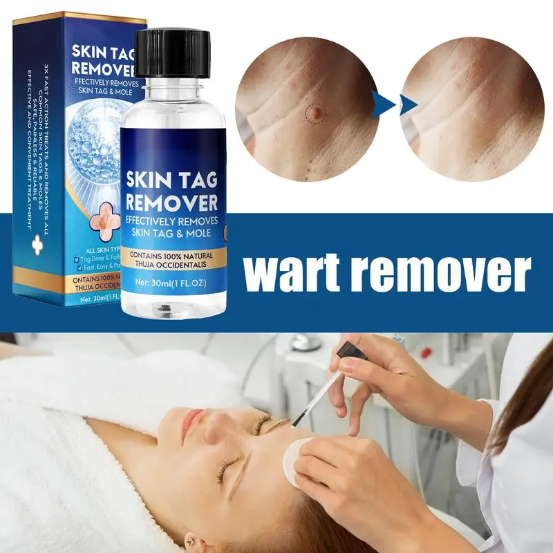 

Skin Tags Repair Lotion Skin Tags Remover Kit Natural And Effective Skin Tags Remover Skin Tags Corrector Mole Repair Lotion