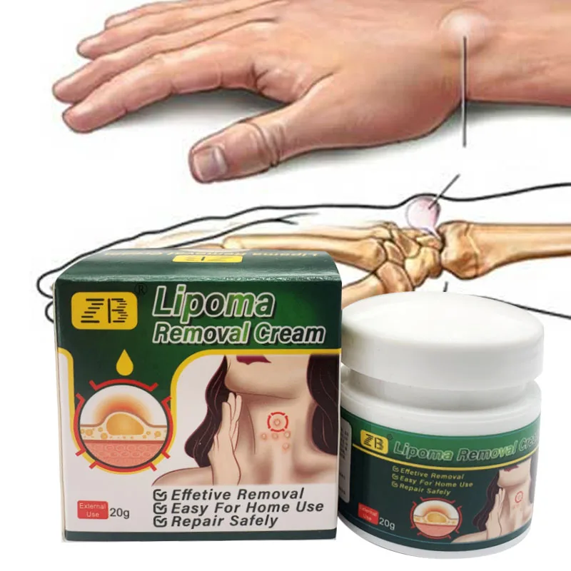 Skin Care Ointment 20g Herbal Lipoma Removal Cream Lipolysis Skin Swelling Cellulite Treatment