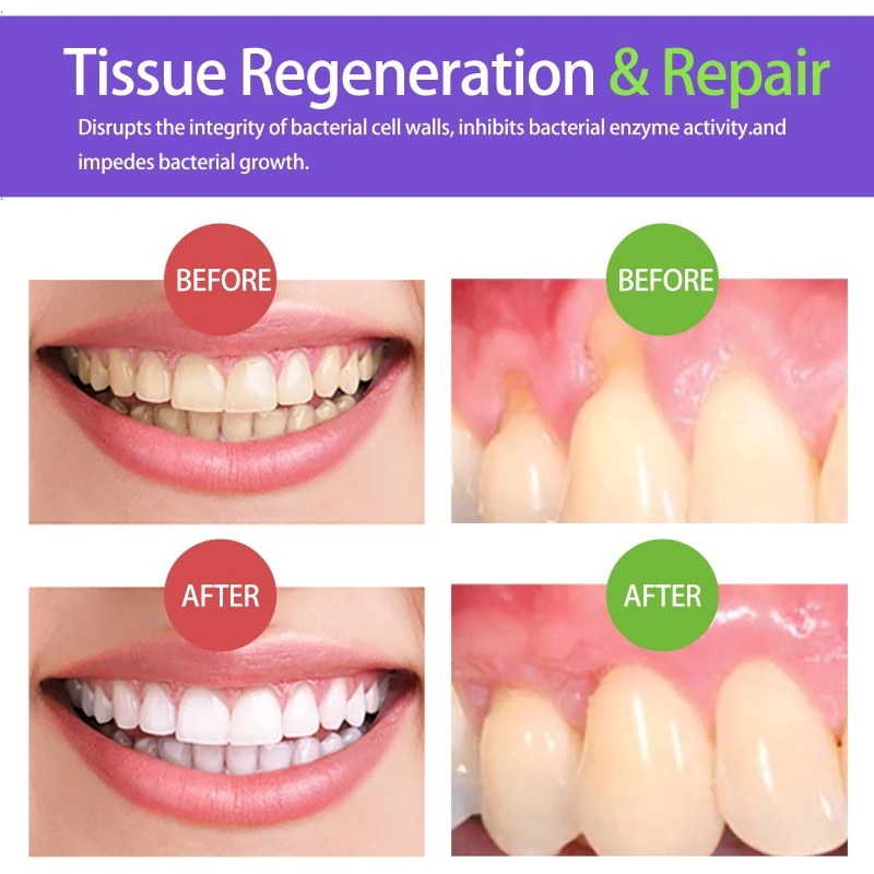Teeth Health Product Gum Repair Drops Teeth Whitening Product Foam Mousse Deep White Cleansing Teeth Stains Calculus Protects Reduce Oral Odor Toothpaste