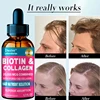 Rapid hair growth essential oil nourishes hair root scalp care repairs hair damage anti-hair loss hair care essence