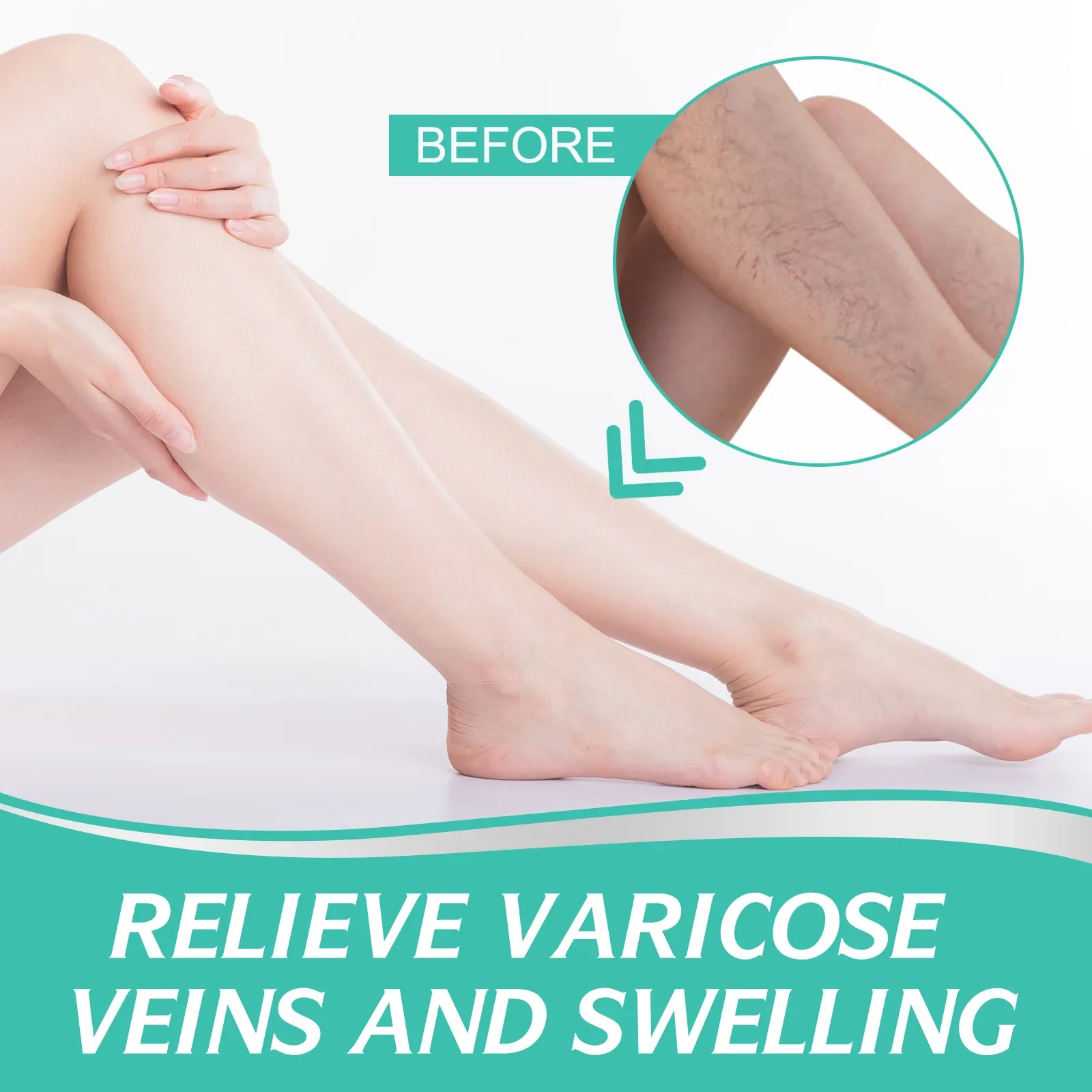 8 PCS Varicose Veins Patch Treatment For Varicose Veins Vasculitis Phlebitis Spider Leg Medical Patch Angiitis Removal