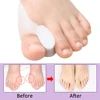 Pexmen 2/4/8Pcs Gel Big Toe Separator Bunion Corrector Pain Relief Hallux Valgus Straighter Orthopedic Toe Protector Spacer 2