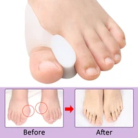 Pexmen 2/4/8Pcs Gel Big Toe Separator Bunion Corrector Pain Relief Hallux Valgus Straighter Orthopedic Toe Protector Spacer 2