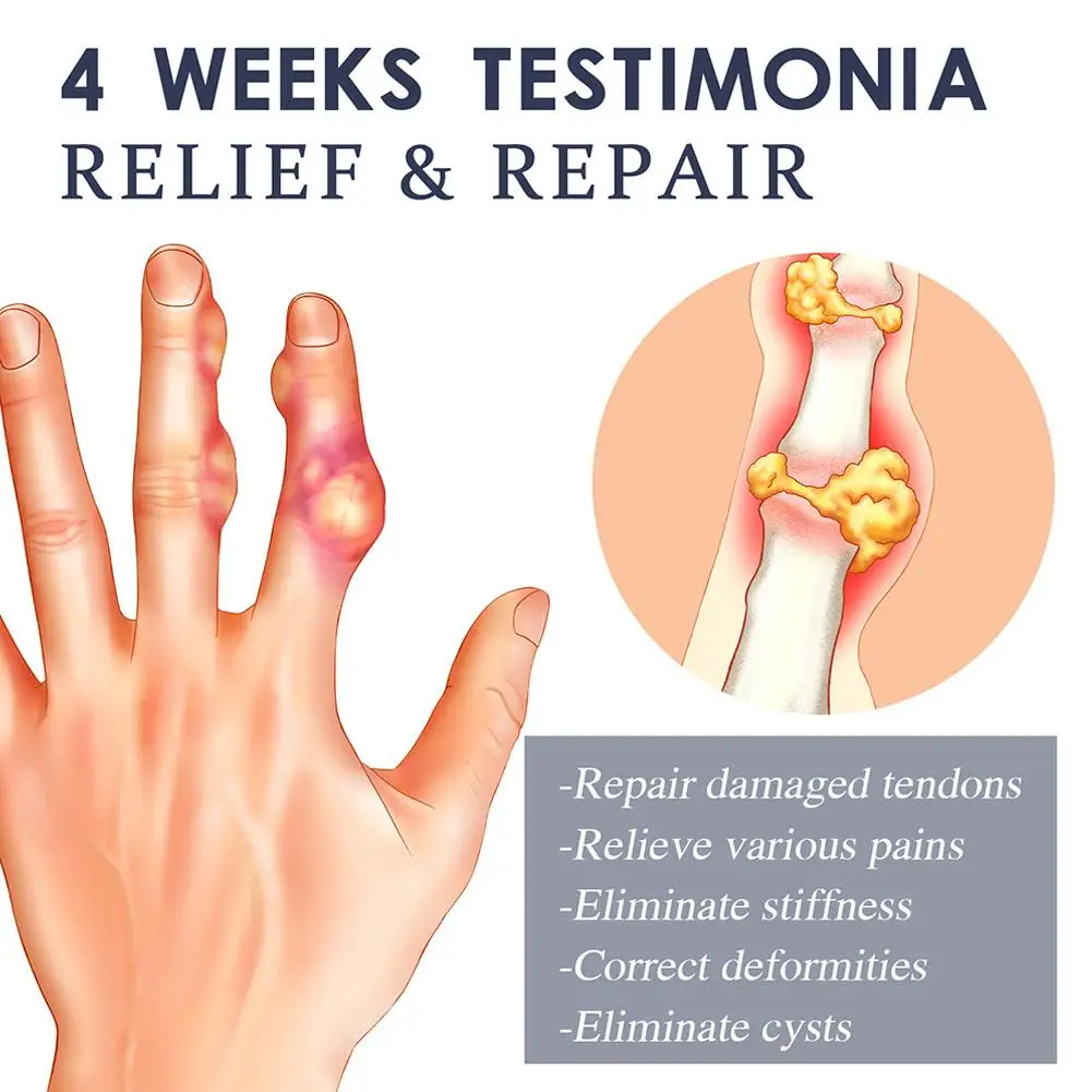 Рисунок 6 - Крем Beevenom для снятия симптомов боли в коленях