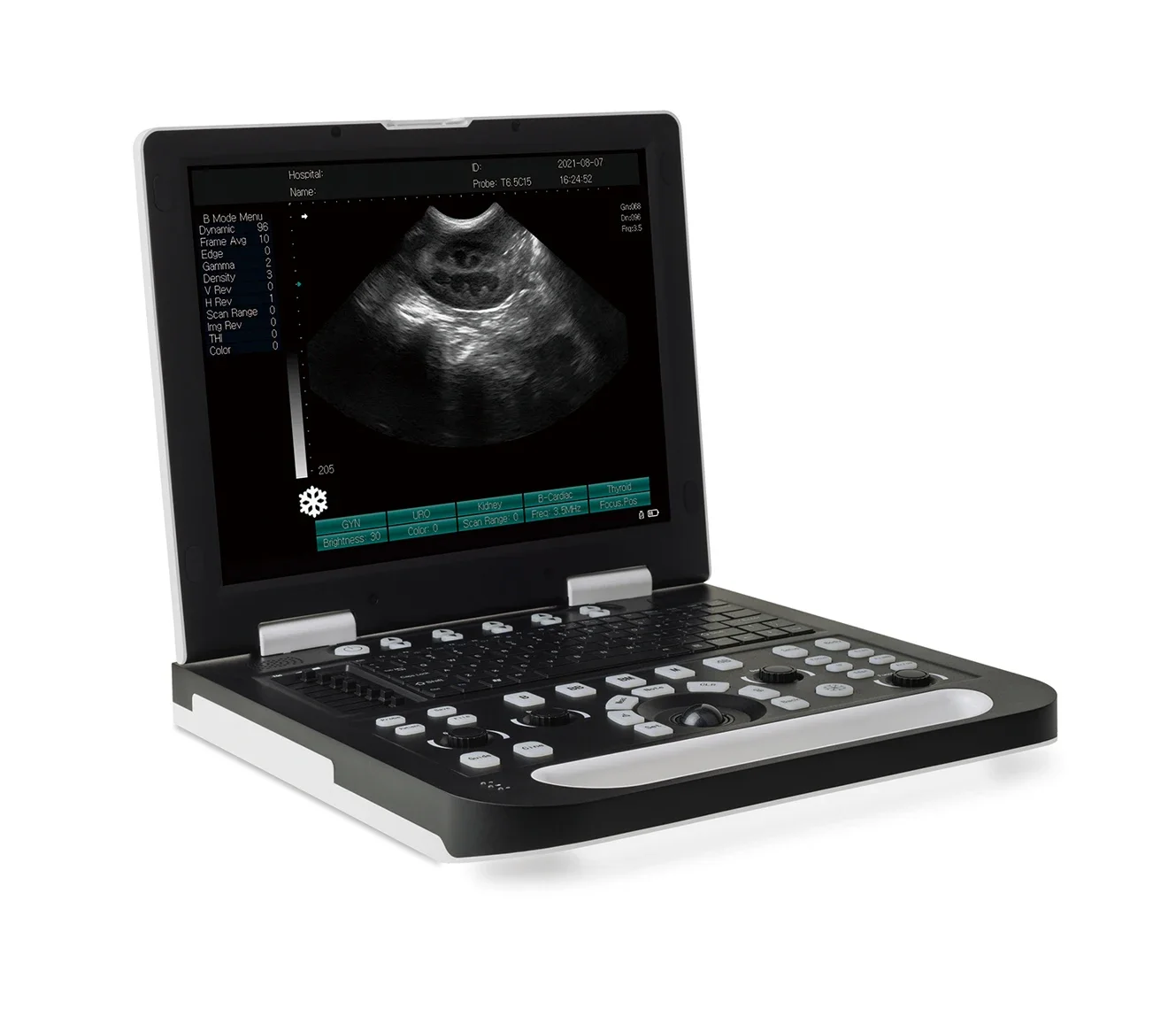 

15 Inch LED Screen Animal Medical Equipment Ultrasound Machine Echocardiography Veterinary Ultrasound