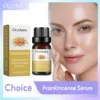 Frankincense Essential Oil For Diffuser Fade Fine Lines Hydrating Lightening Face Serum Improve Dry Frizzy Nourish Hair Essence 1