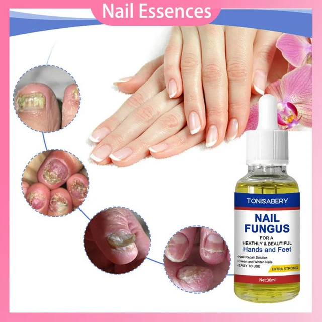 Emtrix Fungal Nail Treatment - FootcareUK.com