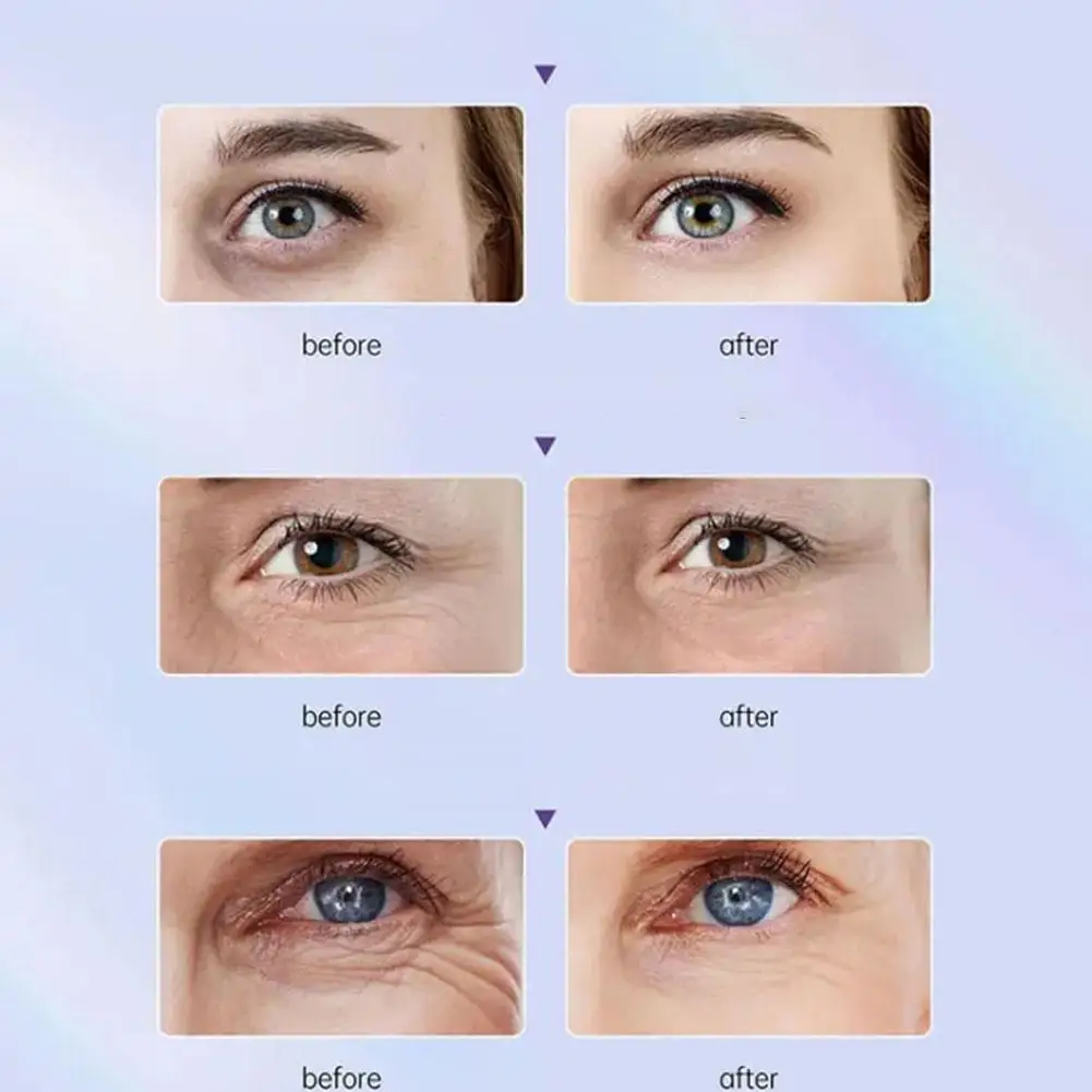 Рисунок 6 - Крем для области вокруг глаз увлажняющий