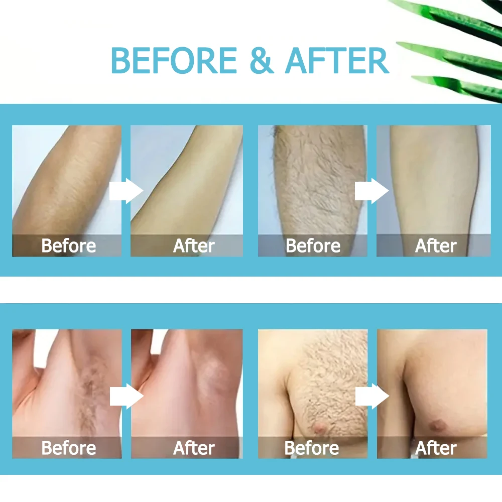Painless Hair Removal Underarm Private Facial Body Leg Hair Remove Cream  Skin Care Powerful Beauty Hair Removal For Men Women 3