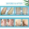 Painless Hair Removal Underarm Private Facial Body Leg Hair Remove Cream  Skin Care Powerful Beauty Hair Removal For Men Women 3